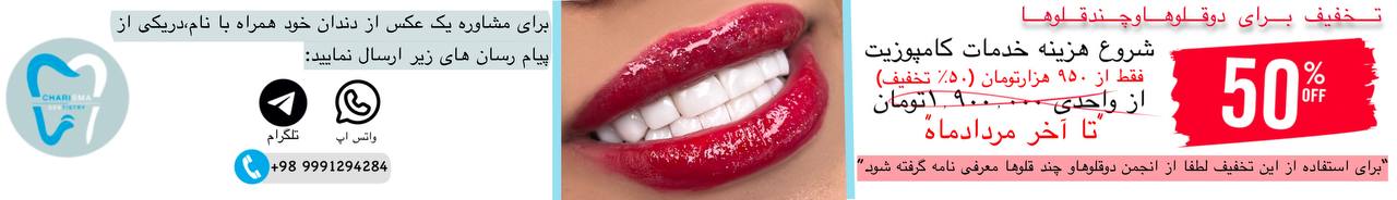 خدمات تخصصی زیبایی دندان کاریزما